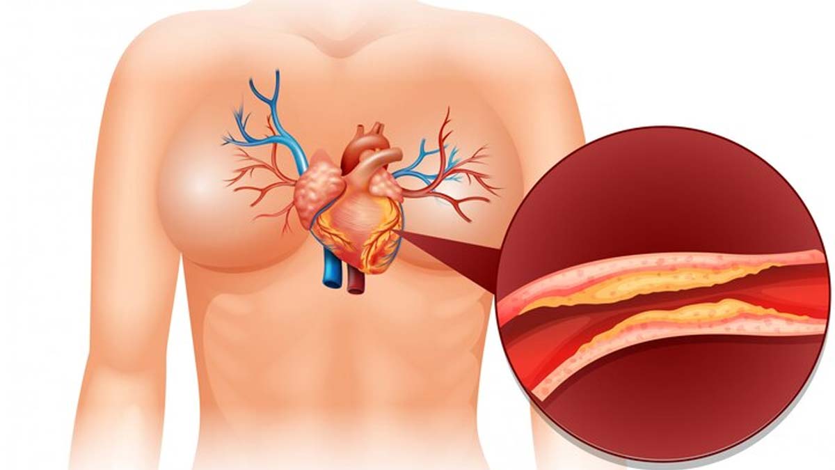 Why Is Cholesterol Important For Health, How To Lower Bad Cholesterol?